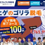 非公開: ゴリラクリニックのヒゲ脱毛ってどう？