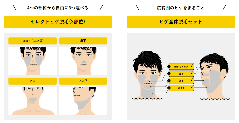 メンズリゼレーザー脱毛照射範囲