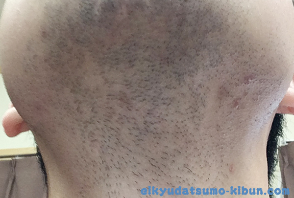 次の日の朝のヒゲ3