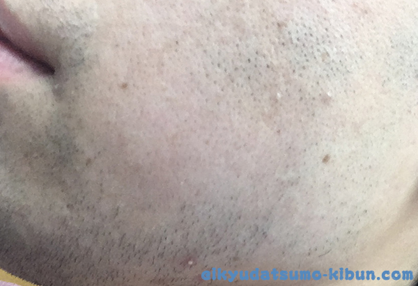 次の日の朝のヒゲ2