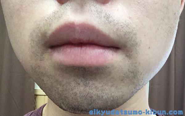 次の日の朝のヒゲ1