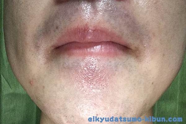 3回目終了後正面