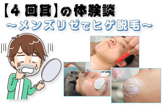 【4回目】メンズリゼのヒゲ脱毛コース～丁寧な施術に安堵～