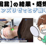 非公開: 【メンズリゼ5回目終了後】ヒゲの部位ごとの脱毛結果と感想