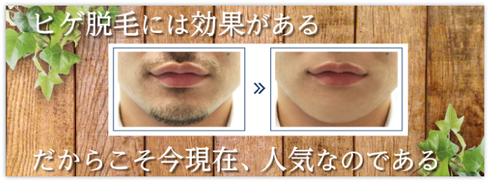 ヒゲ脱毛に効果はある