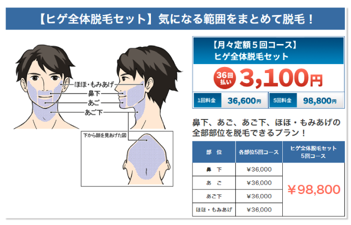 ヒゲ全体料金