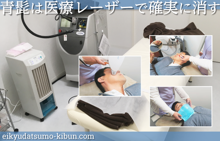 青髭はレーザー脱毛でなくす