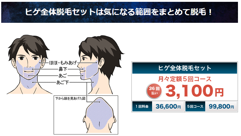 ヒゲ全体脱毛に変更